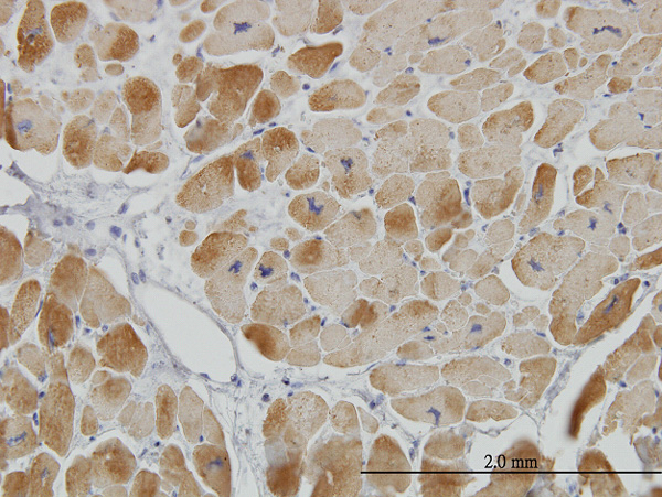 2 - ACADVL Antibody (monoclonal) (M01) AT1019a