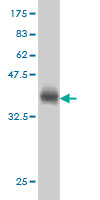 1 - ACADVL Antibody (monoclonal) (M01) AT1019a