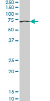 1 - ACADVL Antibody (monoclonal) (M01) AT1019a