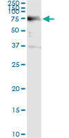 5 - ACD Antibody (monoclonal) (M02) AT1023a
