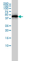 1 - ACTR3 Antibody (monoclonal) (M02) AT1035a