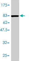 1 - ACY1 Antibody (monoclonal) (M01) AT1037a