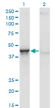 1 - ACY1 Antibody (monoclonal) (M01) AT1037a