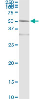5 - ACY1 Antibody (monoclonal) (M01) AT1037a