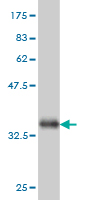 1 - ADPGK Antibody (monoclonal) (M01) AT1057a