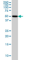 1 - ADPGK Antibody (monoclonal) (M01) AT1057a