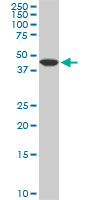 1 - ADPGK Antibody (monoclonal) (M01) AT1057a