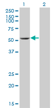 1 - ADPGK Antibody (monoclonal) (M01) AT1057a