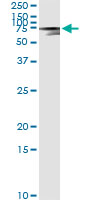 5 - AFP Antibody (monoclonal) (M01) AT1066a