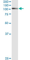 5 - AHR Antibody (monoclonal) (M02) AT1073a