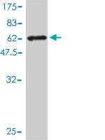 1 - AKR7A2 Antibody (monoclonal) (M01) AT1096a