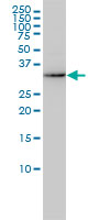 1 - AKR7A2 Antibody (monoclonal) (M01) AT1096a
