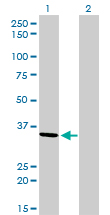 1 - AKR7A2 Antibody (monoclonal) (M01) AT1096a