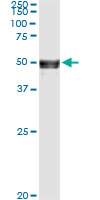 5 - ANGPTL5 Antibody (monoclonal) (M01) AT1139a