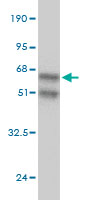 1 - ANP32A Antibody (monoclonal) (M01) AT1145a