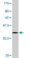 1 - ASB11 Antibody (monoclonal) (M01) AT1210a