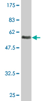 1 - ASGR2 Antibody (monoclonal) (M05) AT1213a