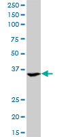 1 - ASGR2 Antibody (monoclonal) (M05) AT1213a