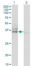 1 - ASGR2 Antibody (monoclonal) (M05) AT1213a