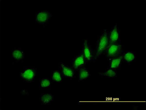3 - ATOX1 Antibody (monoclonal) (M01) AT1228a