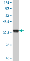 1 - ATOX1 Antibody (monoclonal) (M01) AT1228a