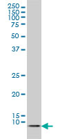 1 - ATOX1 Antibody (monoclonal) (M01) AT1228a