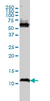 1 - ATPIF1 Antibody (monoclonal) (M01) AT1245a