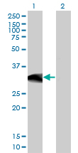 1 - BCL11A Antibody (monoclonal) (M03) AT1281a