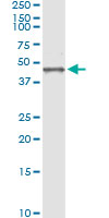 5 - BGN Antibody (monoclonal) (M01) AT1295a