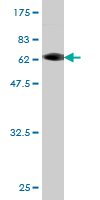 1 - CAB39L Antibody (monoclonal) (M01) AT1360a
