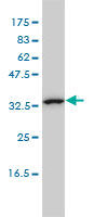 1 - CAB39L Antibody (monoclonal) (M01) AT1360a