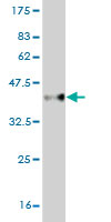1 - CBX2 Antibody (monoclonal) (M04) AT1409a