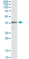 5 - CD5L Antibody (monoclonal) (M01) AT1443a