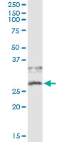 5 - CD79B Antibody (monoclonal) (M01) AT1445a