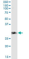 5 - CD83 Antibody (monoclonal) (M01) AT1447a