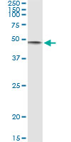 5 - CD86 Antibody (monoclonal) (M01) AT1449a