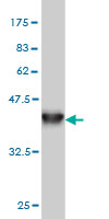 1 - CDADC1 Antibody (monoclonal) (M01) AT1453a