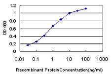 10 - CDADC1 Antibody (monoclonal) (M01) AT1453a