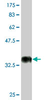 1 - CDADC1 Antibody (monoclonal) (M02) AT1454a