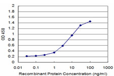 10 - CDS2 Antibody (monoclonal) (M01) AT1485a