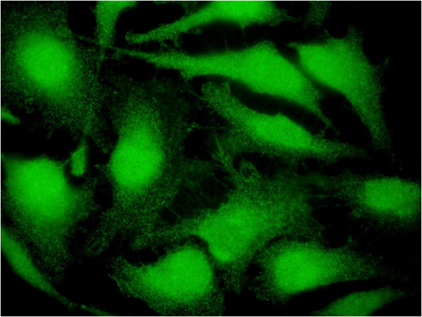 3 - CITED4 Antibody (monoclonal) (M08) AT1542a