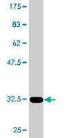 1 - CITED4 Antibody (monoclonal) (M08) AT1542a
