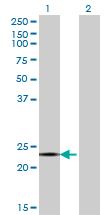 1 - CITED4 Antibody (monoclonal) (M08) AT1542a