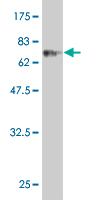 1 - CLN3 Antibody (monoclonal) (M03) AT1561a
