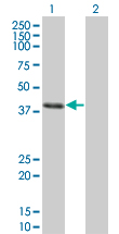 1 - CLN3 Antibody (monoclonal) (M03) AT1561a