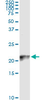 5 - COX4I2 Antibody (monoclonal) (M01) AT1598a