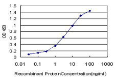 10 - CPS1 Antibody (monoclonal) (M01) AT1608a