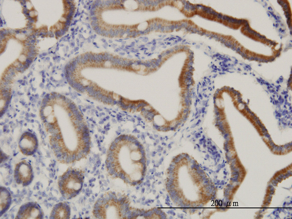 2 - CPS1 Antibody (monoclonal) (M01) AT1608a