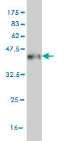 1 - CPS1 Antibody (monoclonal) (M01) AT1608a