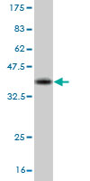 1 - CRKL Antibody (monoclonal) (M03) AT1624a